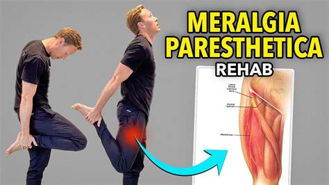 meralgia paresthetica compression test|meralgia paresthetica exercises to avoid.